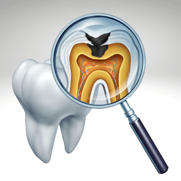 finding the best root canal sealer