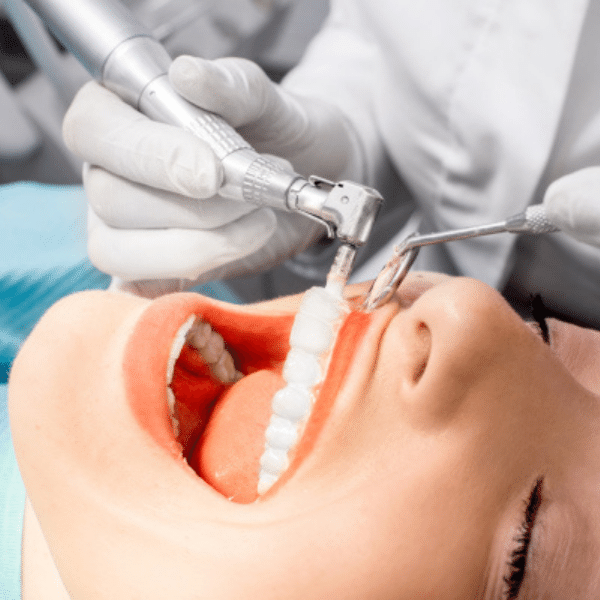tooth polishing tips and tricks